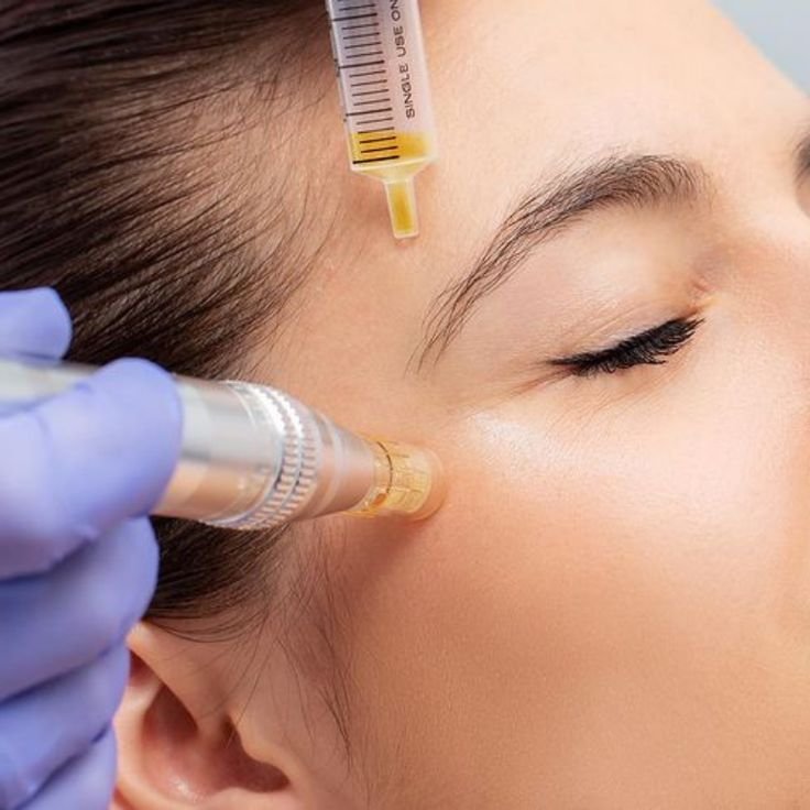 PRP For Face