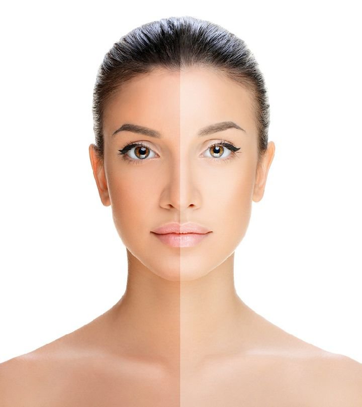 Body Pigmentation Treatment