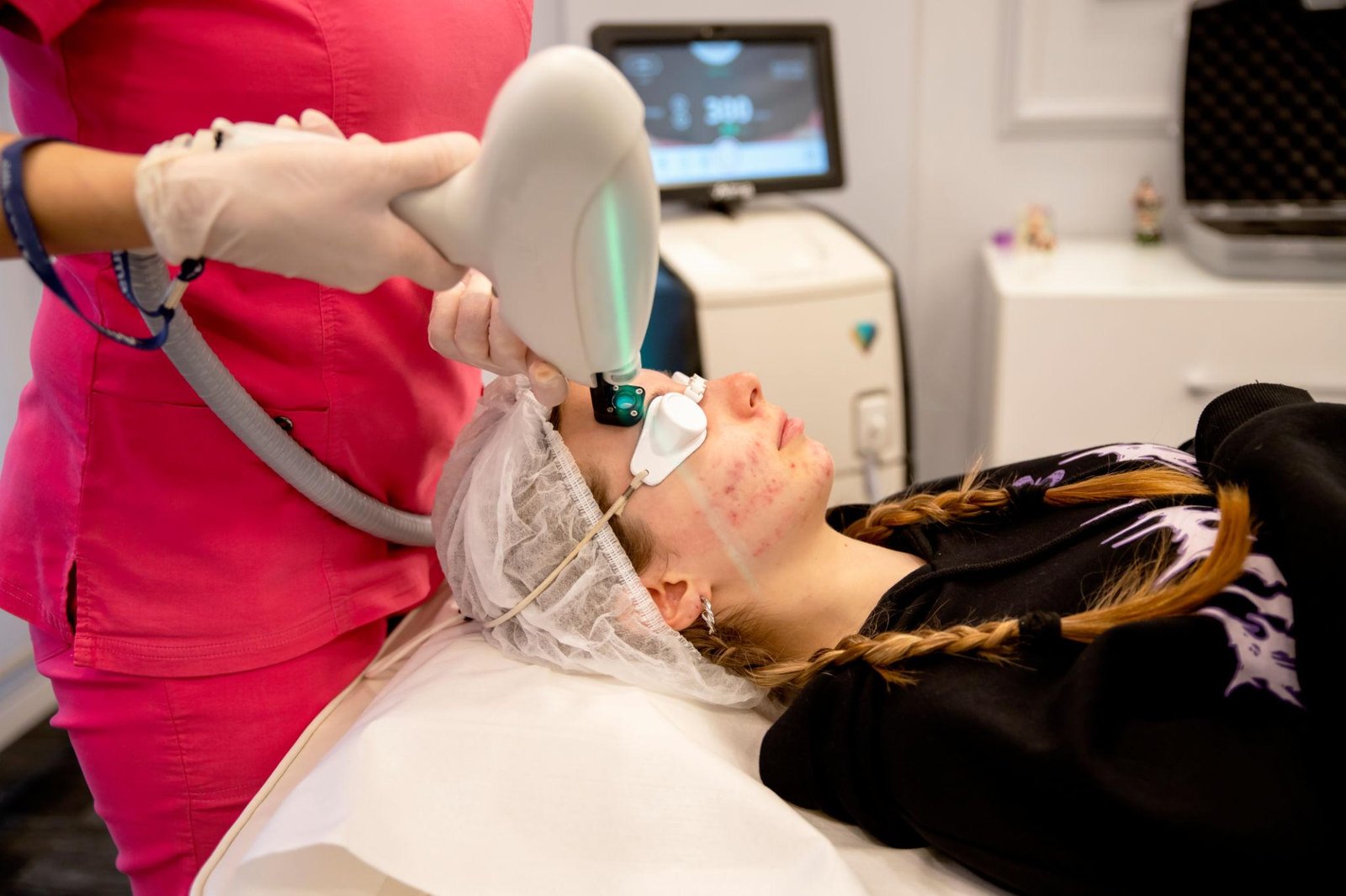 Acne Treatment