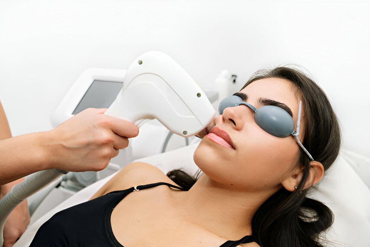 Laser Hair Reduction