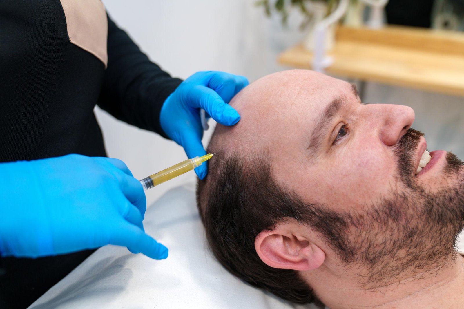 PRP Therapy