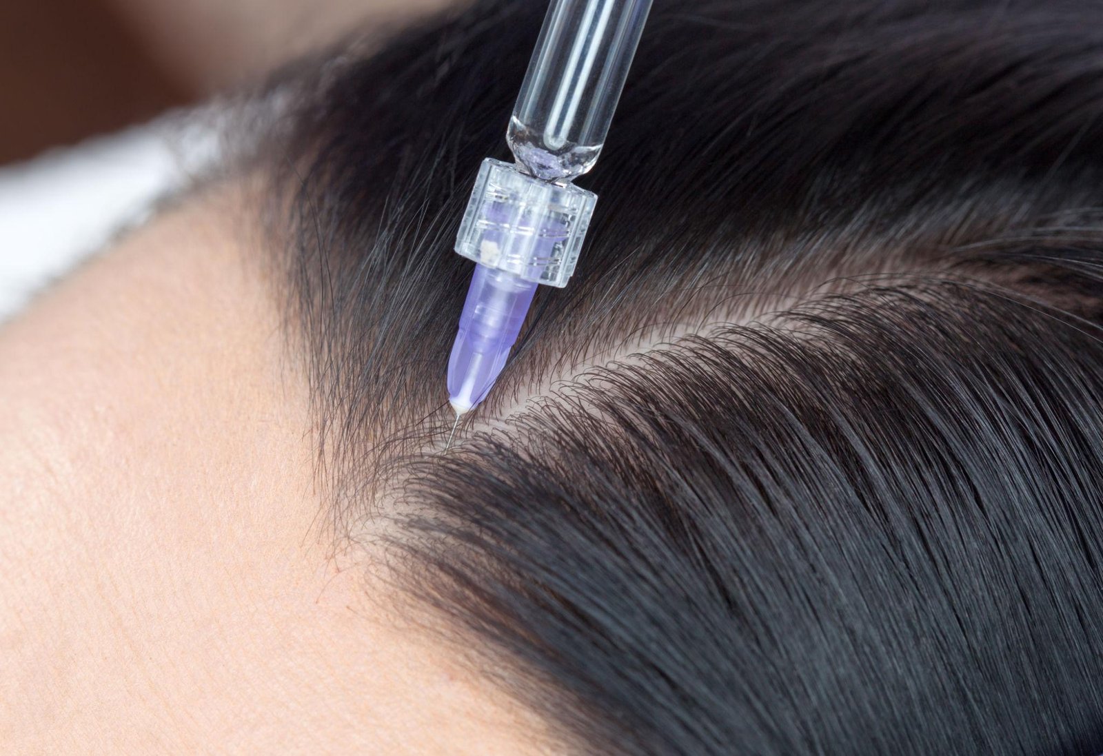 Mesotherapy