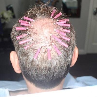 Hair Threads Therapy